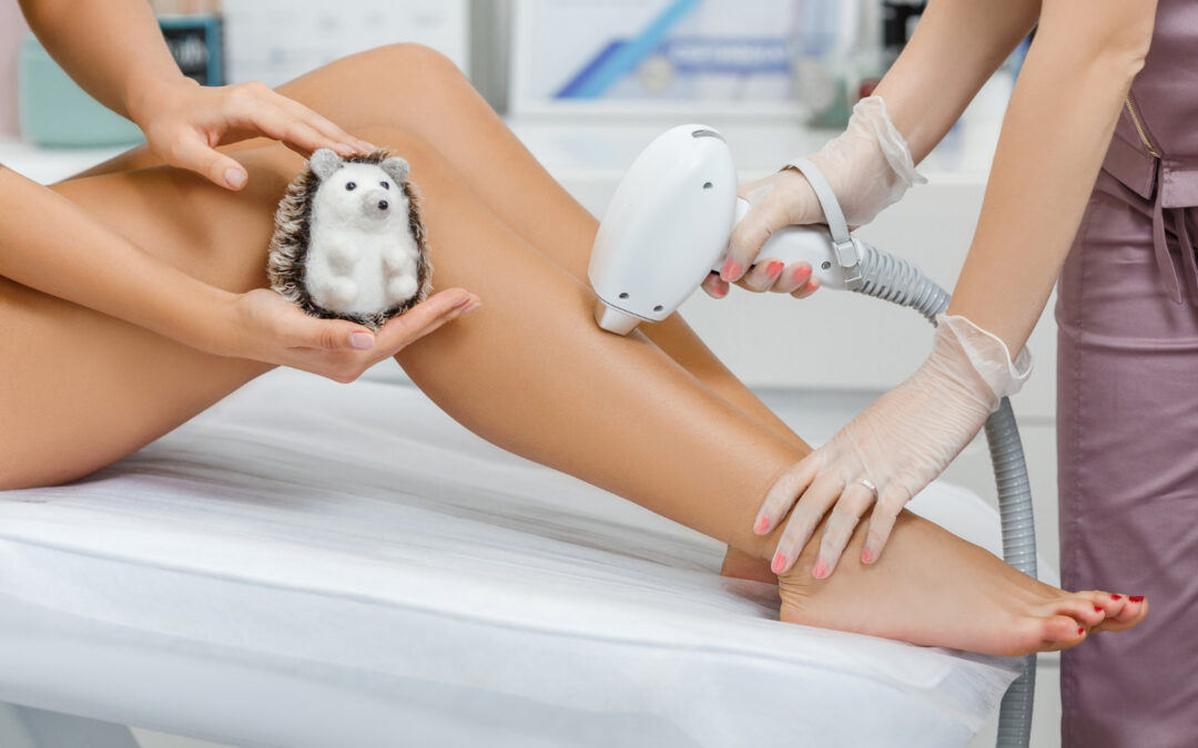 Laserowe usuwanie owłosienia